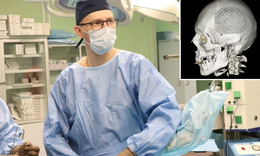 Кт черепа с титановой пластиной. Титановая пластина в черепе. Операция в Новосибирске. Балаковские.