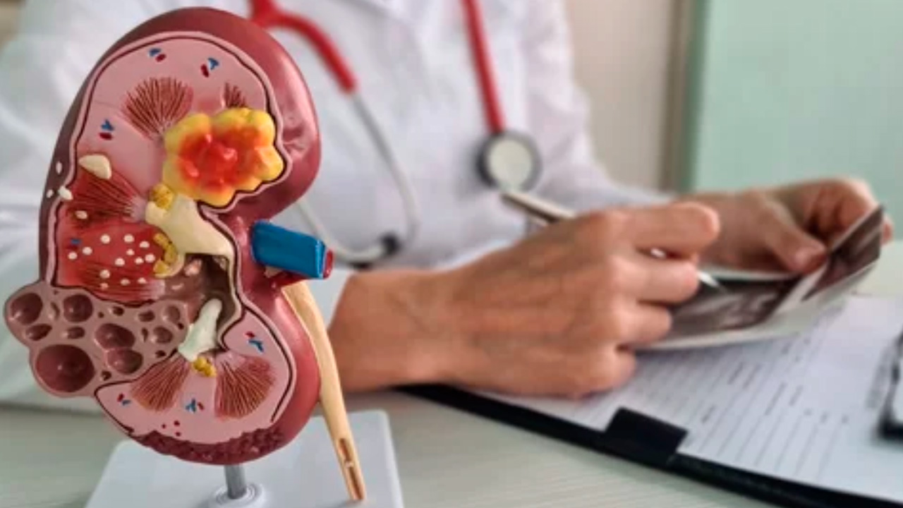 заболевания почек.jpg заболевания почек.jpg