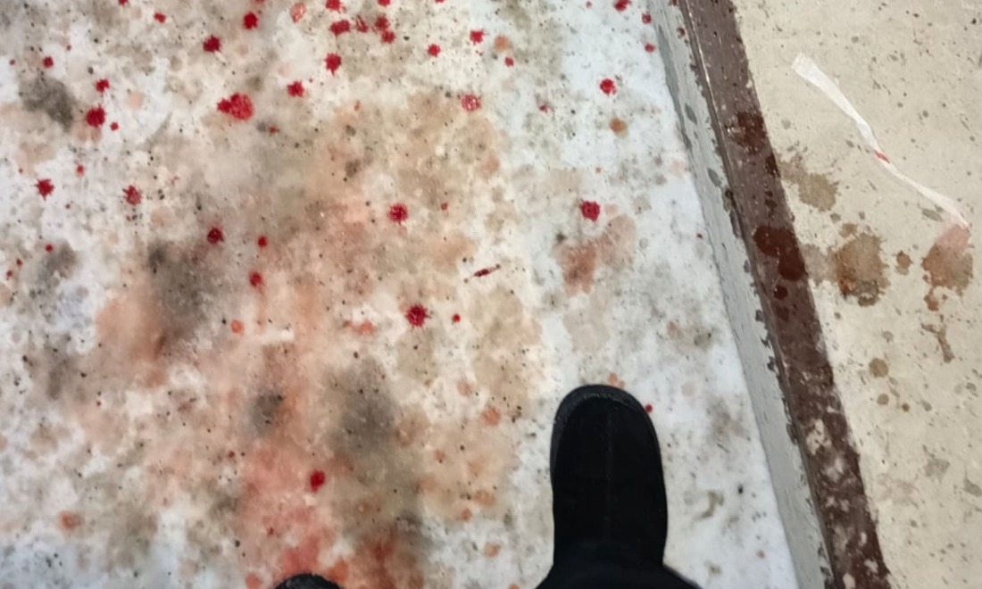 кровь тг кол.jpg