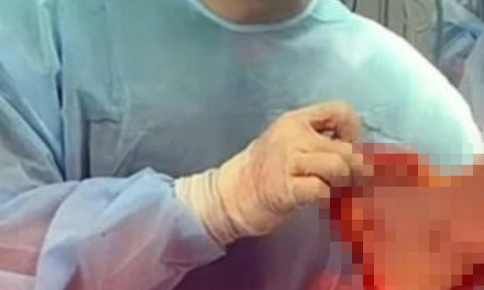 МВД проверит хирурга из Новосибирска за «валентинку» из человеческой кожи