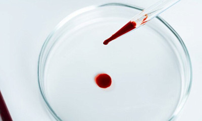 В Академгородке Новосибирска создали уникальную тест-систему анализа крови