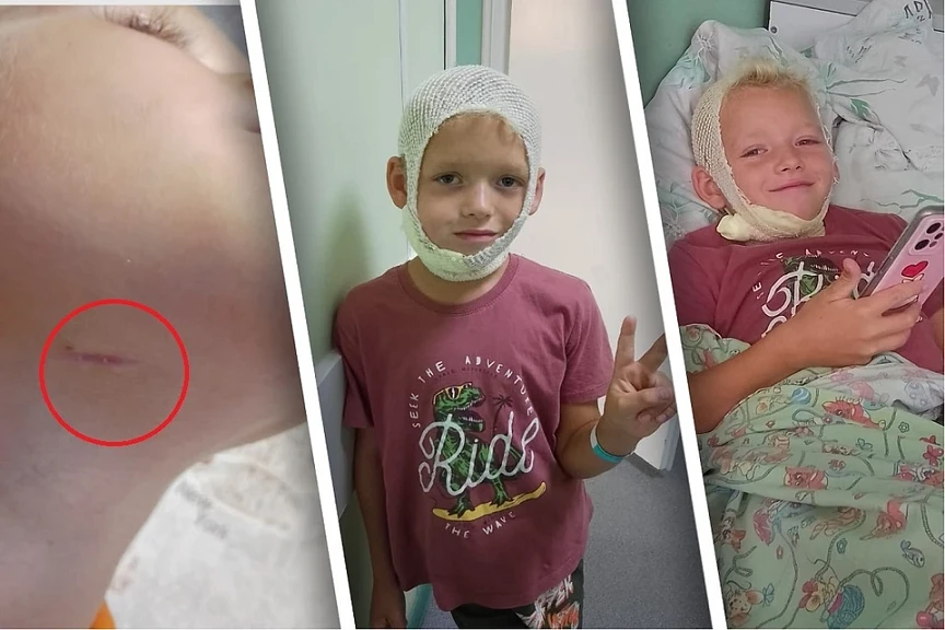 В Новосибирской области ребёнок чуть не умер из-за вовремя не удалённого зуба